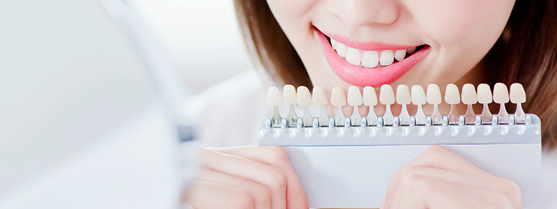 ホームホワイトニングとは