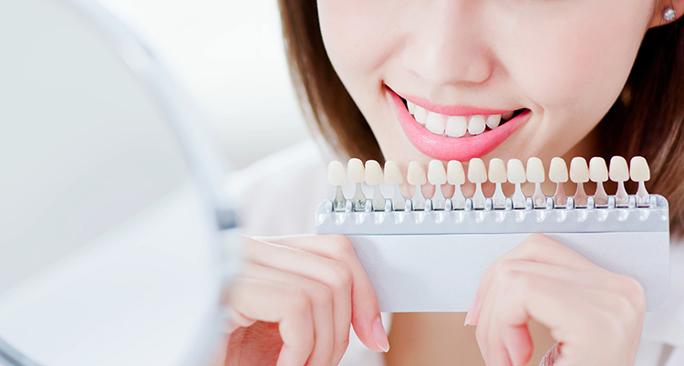 ホームホワイトニングとは