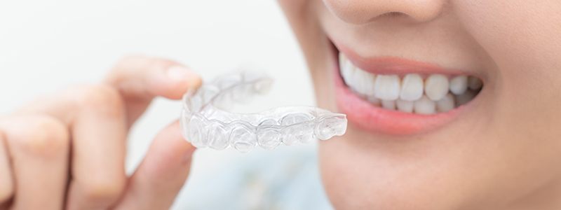 矯正歯科について