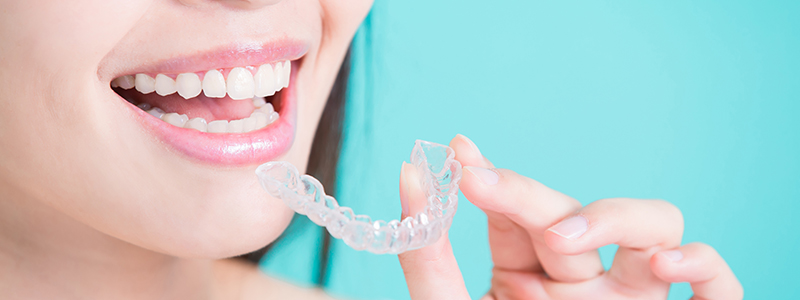 インビザライン