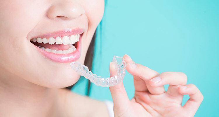 マウスピース矯正