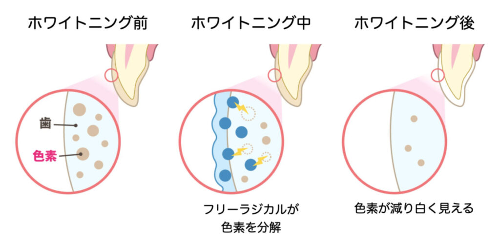 フリーラジカル