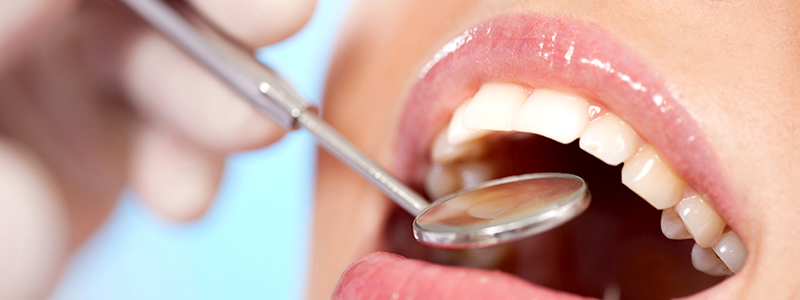 ご自身の歯を長く残すために今できること