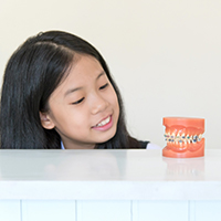 子供の矯正歯科