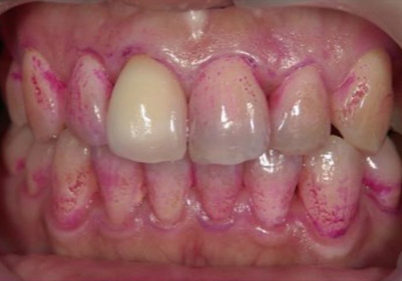 キッズスペース