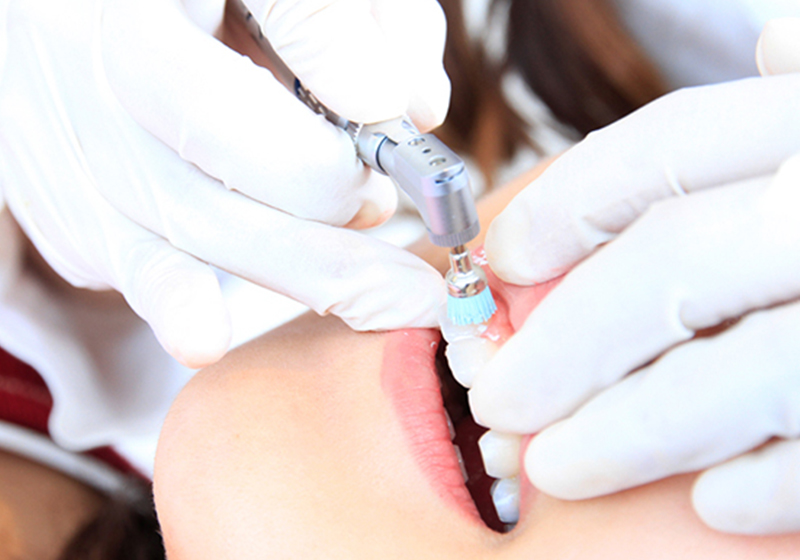 メインテナンス