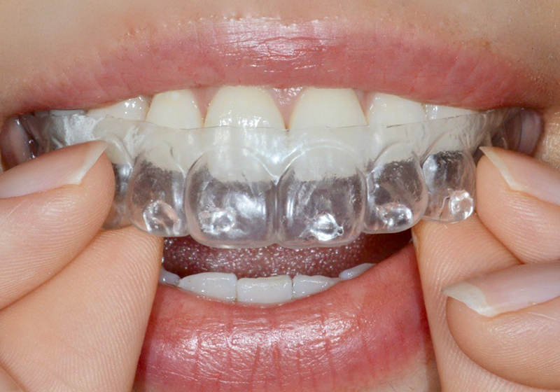 はみ出たジェルをティッシュで拭きとる写真