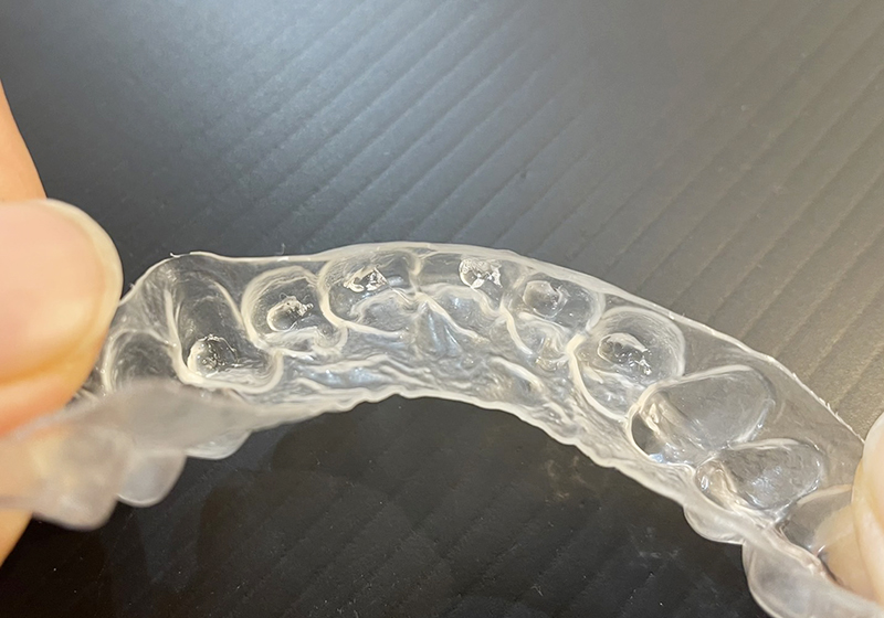 マウスピースを装着した写真