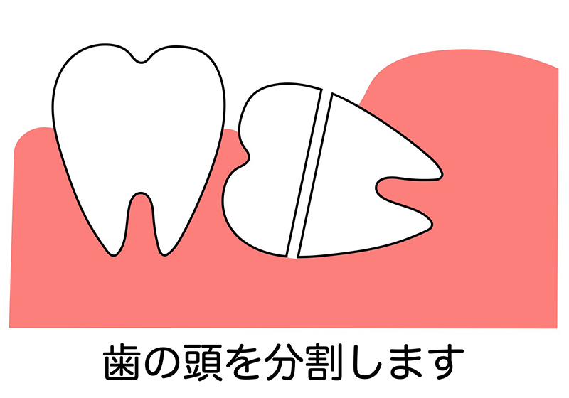 イラストを入れる